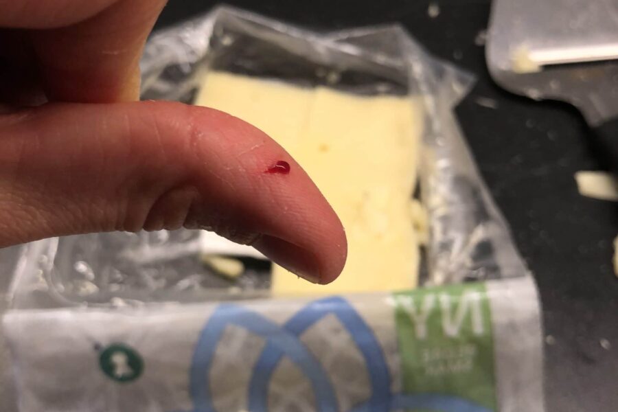 I cut myself on the cheese slicer