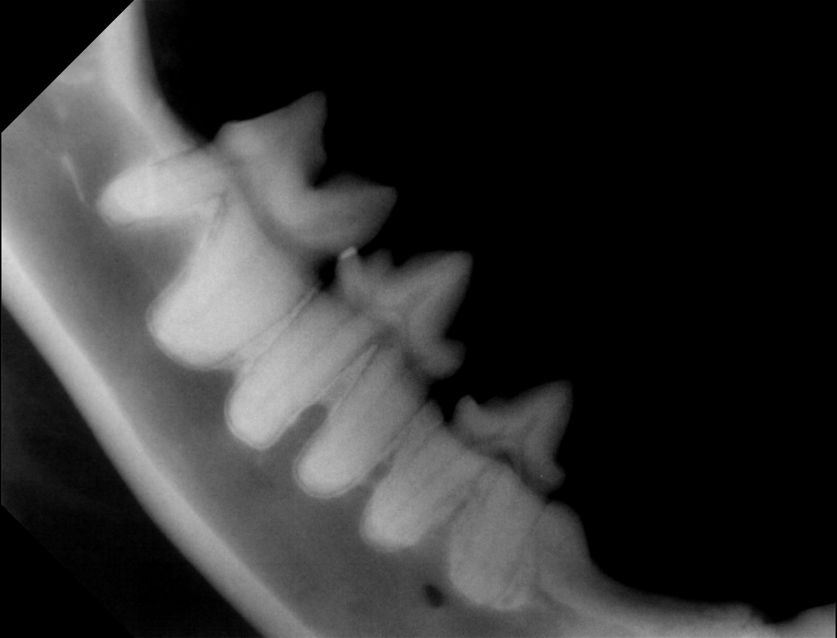 X-ray of Vira's teeth, in the back (2023)