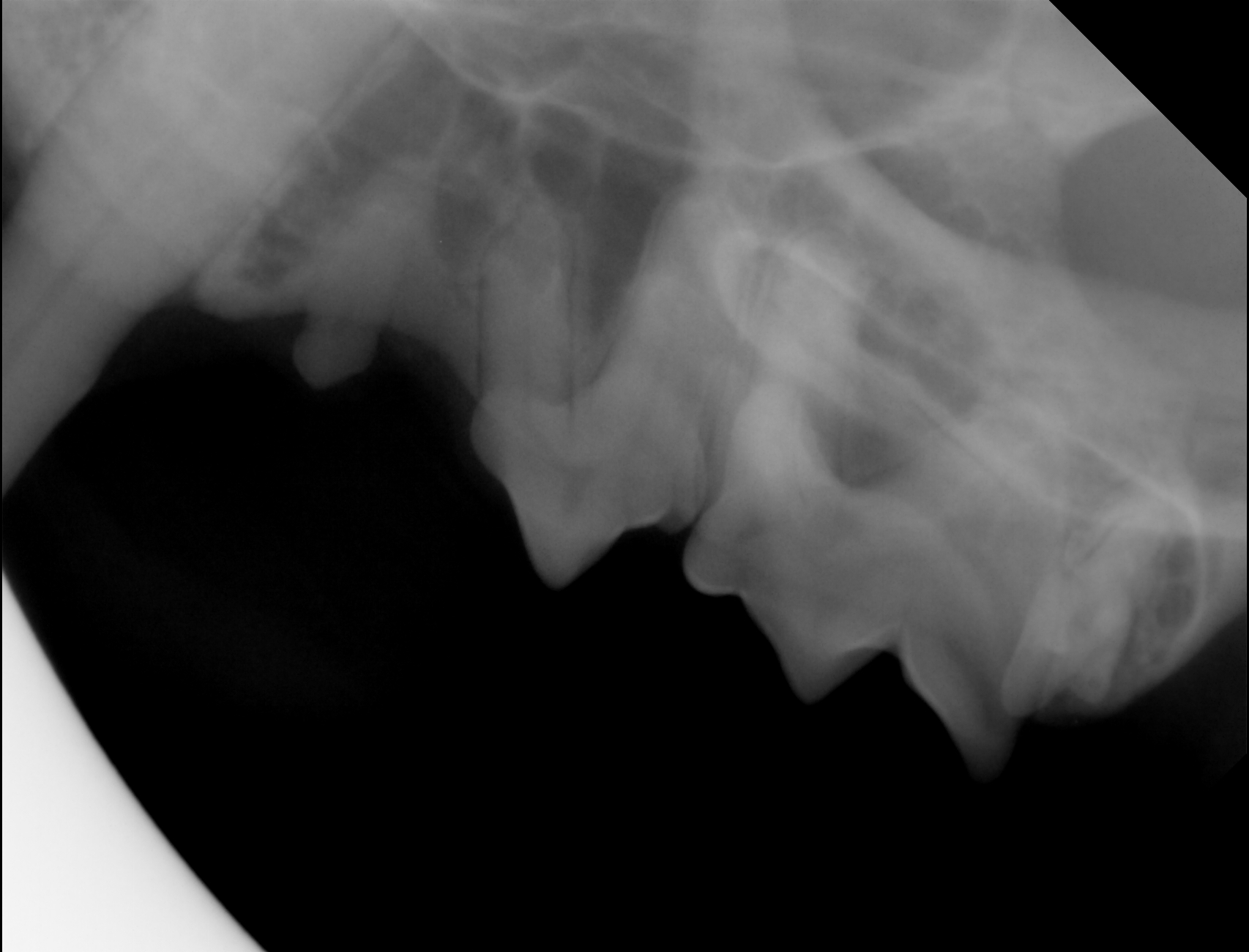 X-ray of Vira's teeth (2023)