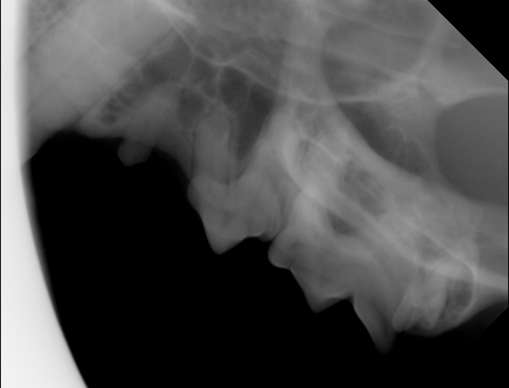 X-ray of Vira's teeth (2024)