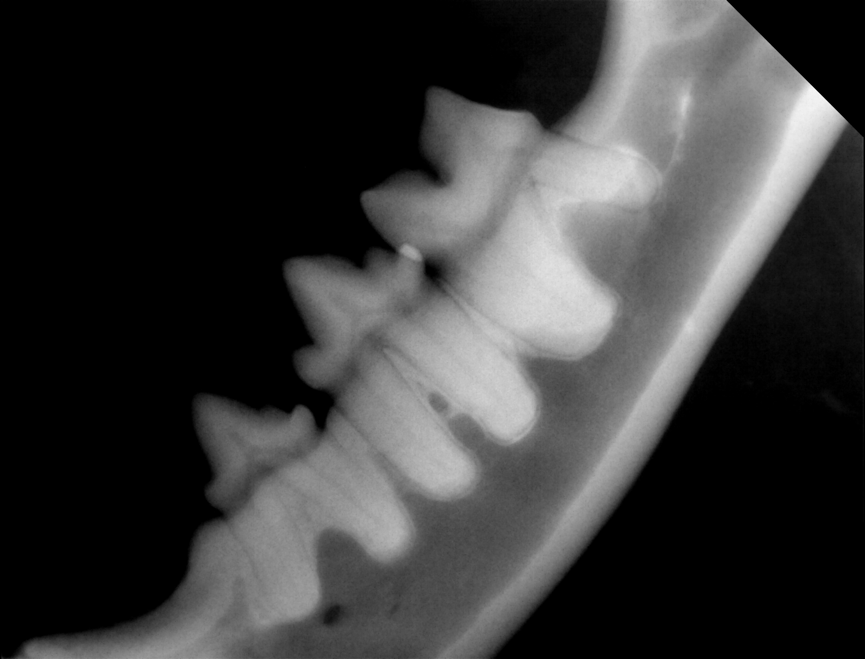 X-ray of Vira's teeth, in the back (2023)