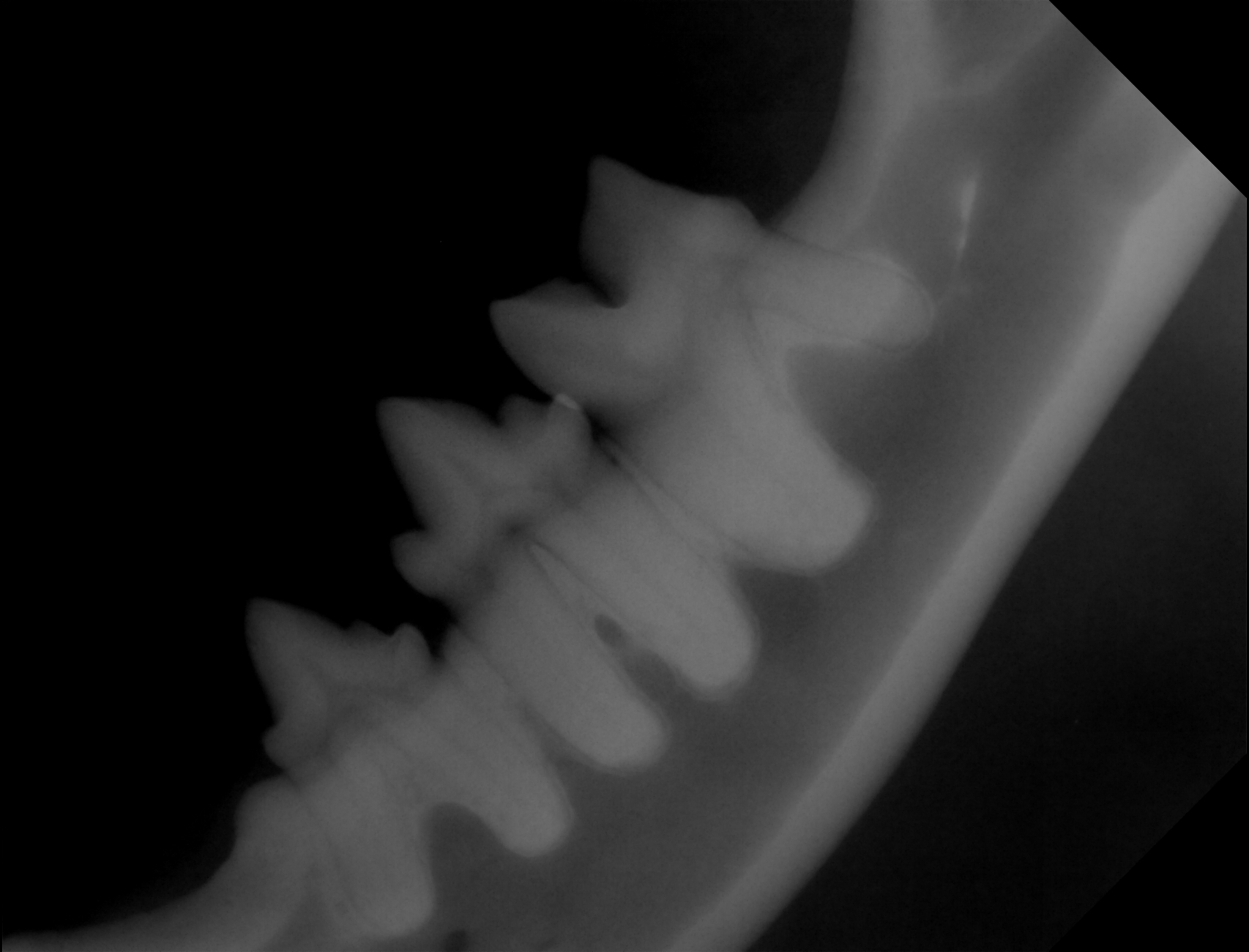 X-ray of Vira's teeth, in the back (2024)